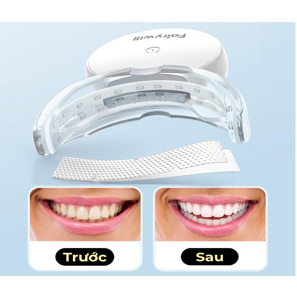 Trước và sau khi thực hiện tẩy trắng răng