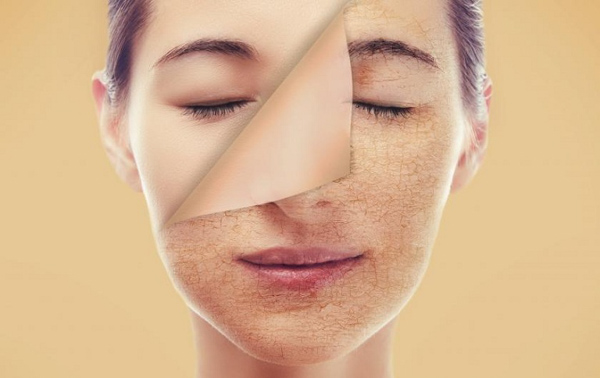 Da khô và thiếu độ ẩm ở độ tuổi trung niên