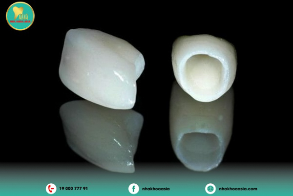 Răng sứ toàn sứ Răng sứ toàn sứ