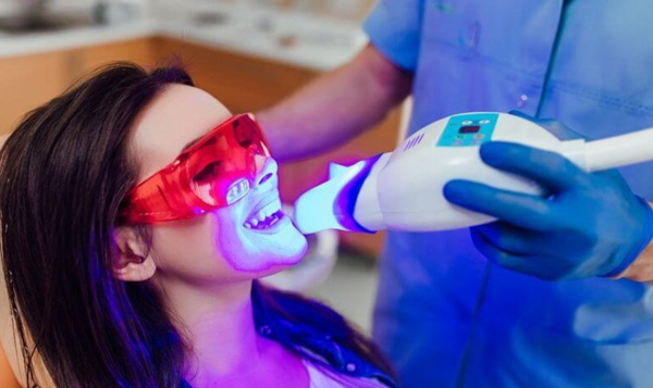 Phương pháp tẩy trắng răng bằng công nghệ Laser