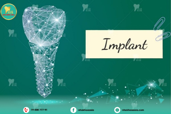 Cấy Ghép Răng Implant là gì? Cấy Ghép Răng Implant là gì?